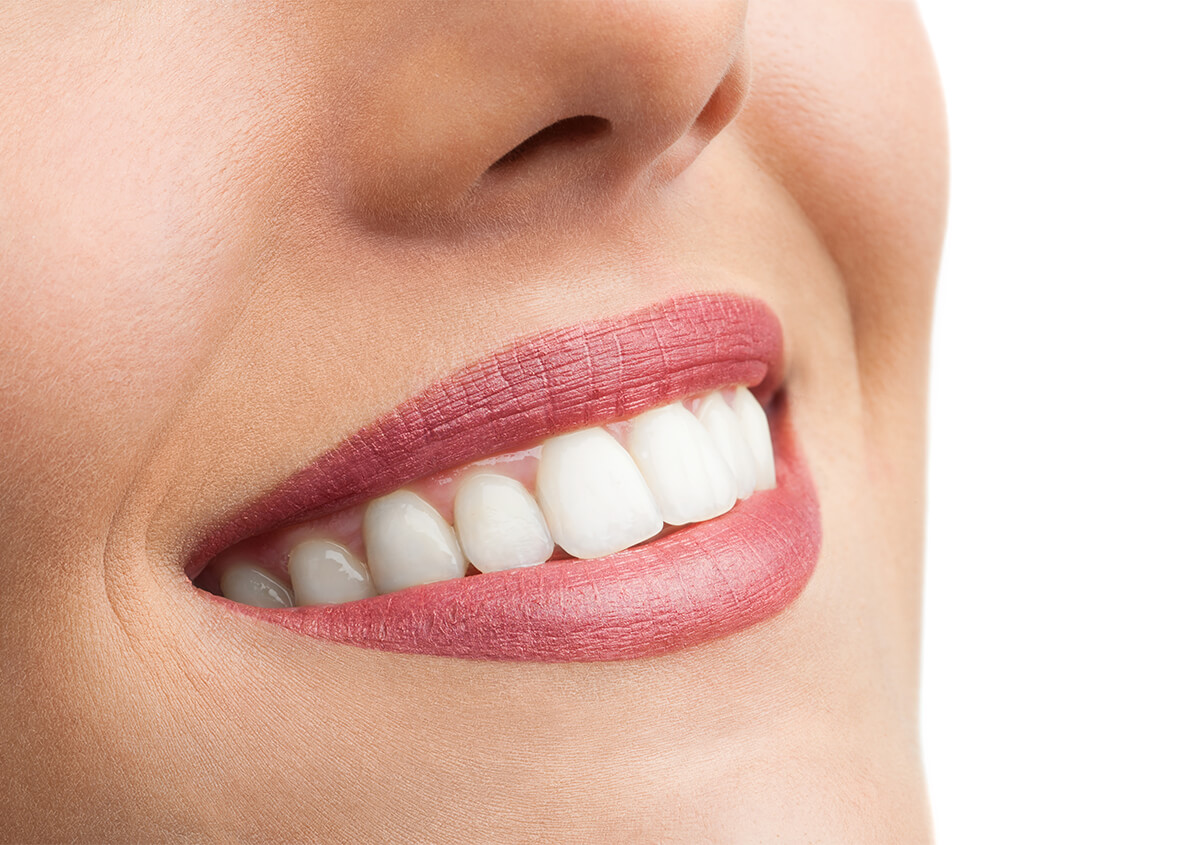 Teeth Whitening for Sensitive Teeth in San Marcos CA Area