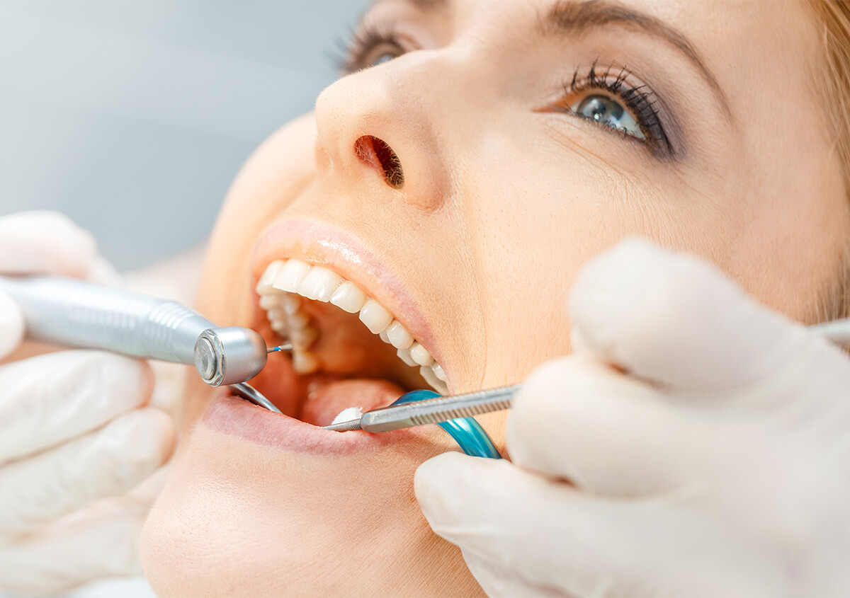 Tooth Decay Restoration in San Marcos CA Area